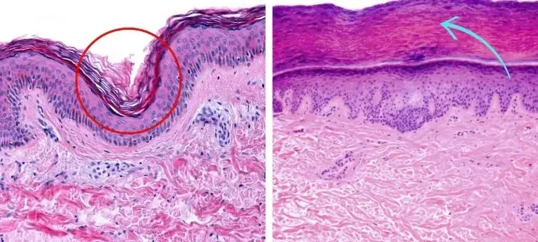Skin layers showing the three root causes of visible aging beneath the surface